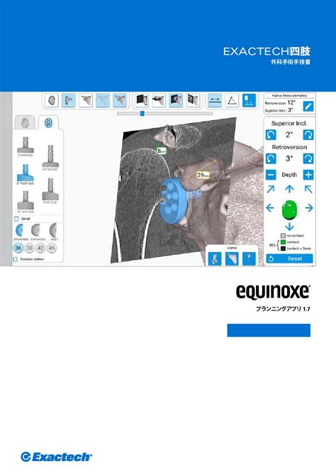 ezectech|exactech japan.